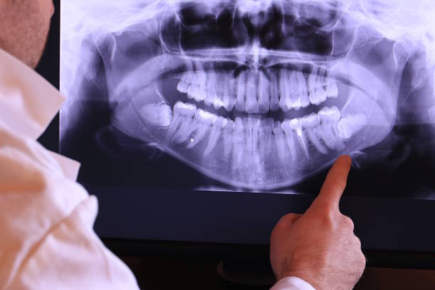 Best Emergency Gum Treatment in Owosso, MI